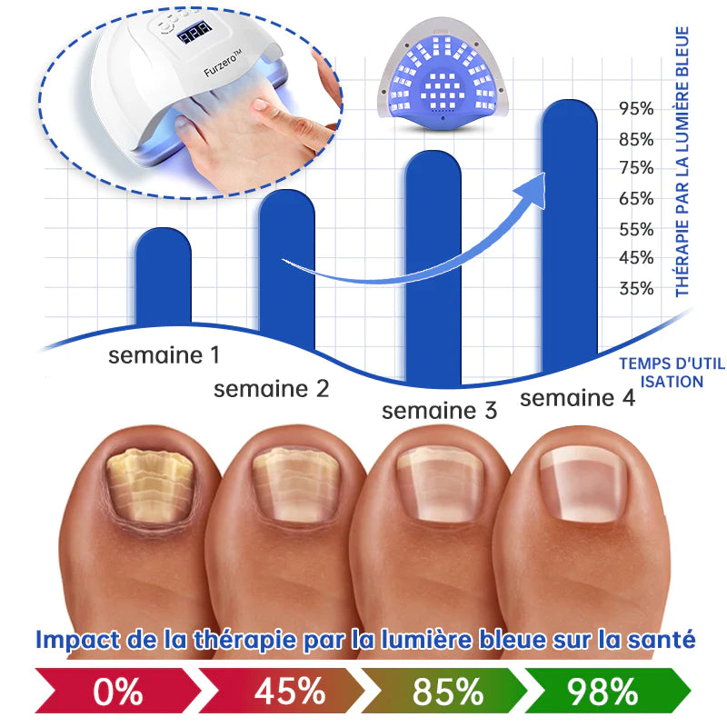 PureNailMC | Appareil de thérapie laser fongique - votre arme secrète contre la mycose des ongles