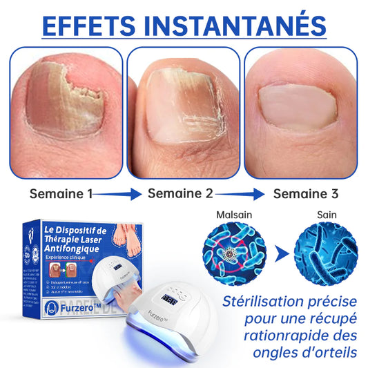 PureNailMC | Appareil de thérapie laser fongique - votre arme secrète contre la mycose des ongles