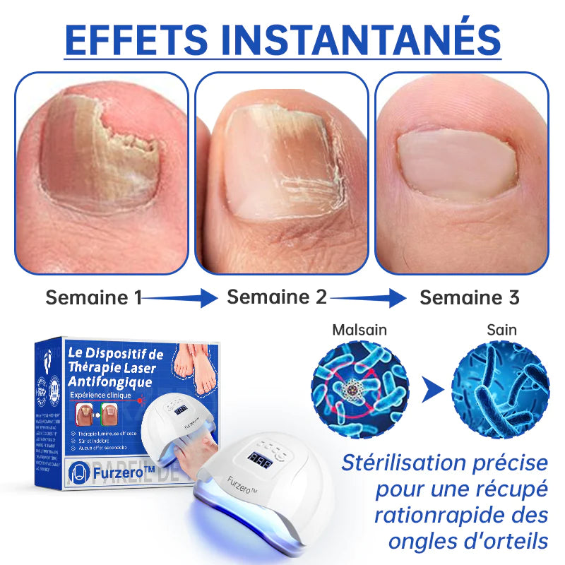 PureNailMC | Appareil de thérapie laser fongique - votre arme secrète contre la mycose des ongles