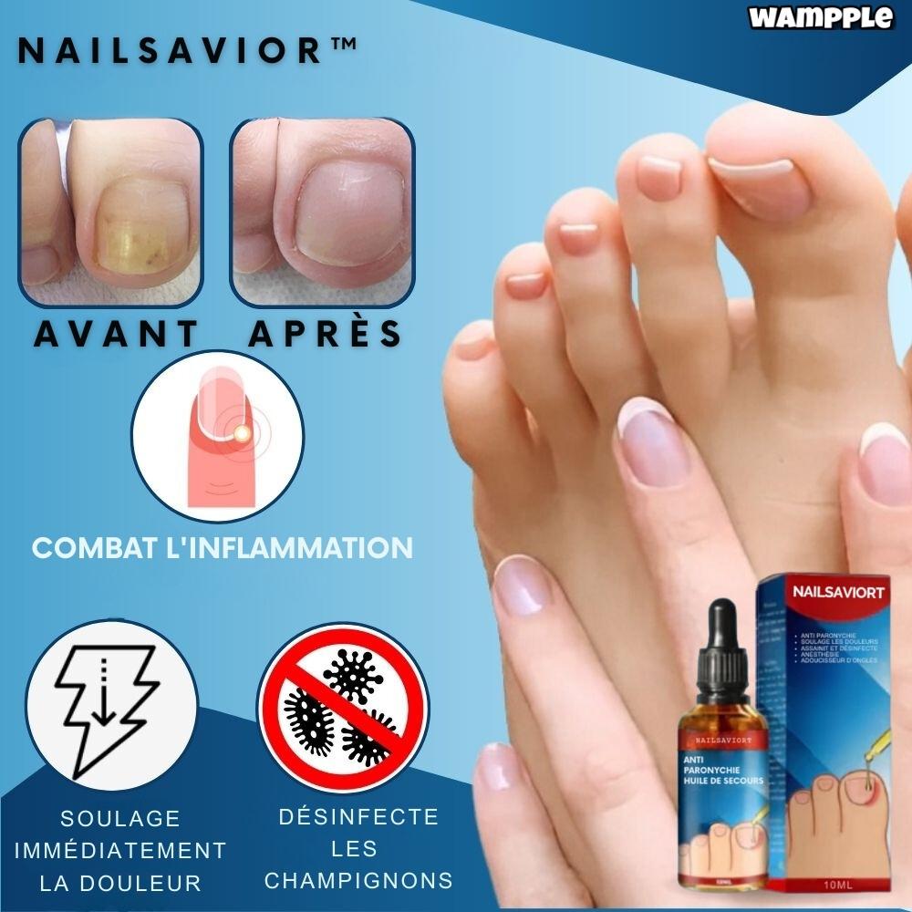 NailSaviort™ - Guérit les ongles des pieds et des mains | 1+1 GRATUIT TEMPORAIRE